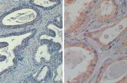AKT1, p Thr308 Antibody (18F3.H11), Novus Biologicals 0.1mg; Unlabeled:Antibodies,